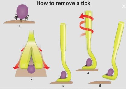 Tick Removal Tool Pack of 2 - Image 2